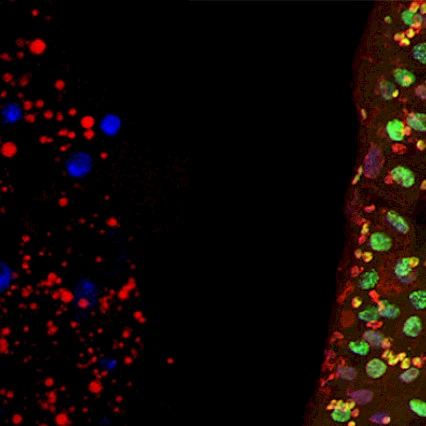 Aging and Metabolism