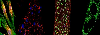 Aging and Metabolism