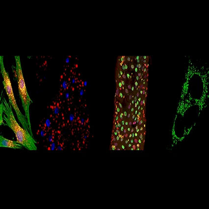 Aging and Metabolism